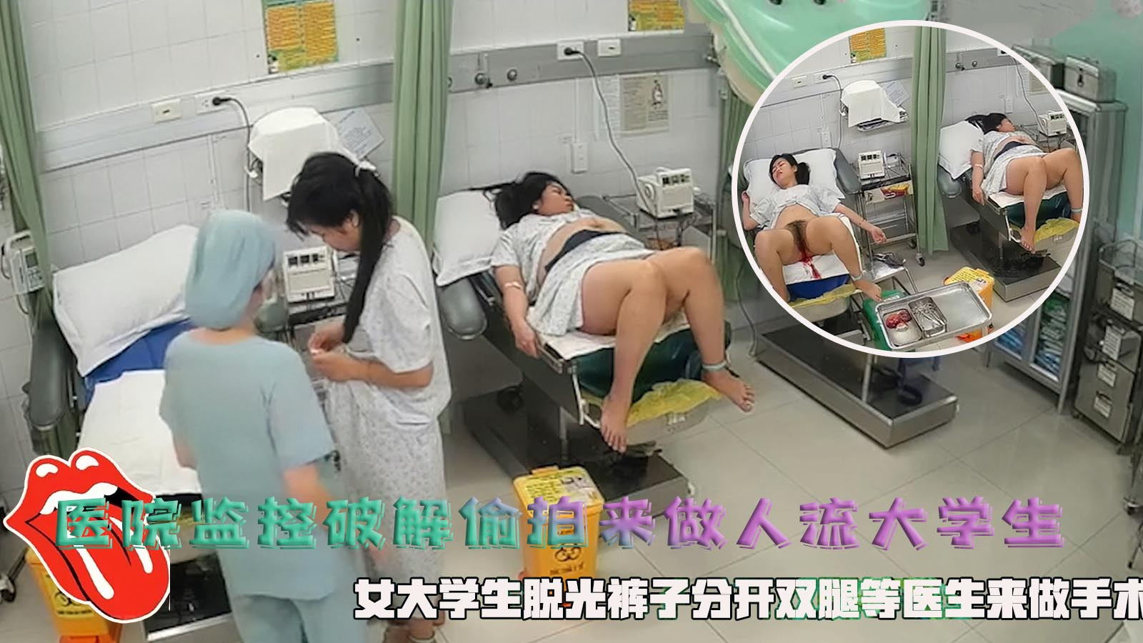医院监控破解偷拍来做人流大学生,女大学生脱光裤子分开双腿等医生来做手术。